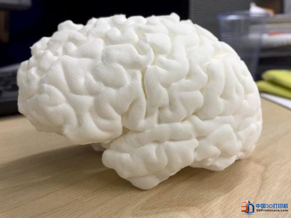 未來醫療行業 3D打印技術融入其中的四種方式

3D醫療行業,3D打印心臟,3D打印大腦,3D打印應用,3D打印領域,3D打印和醫療的關系,3D打印平臺,3D打印服務,3d打印企業服務平臺