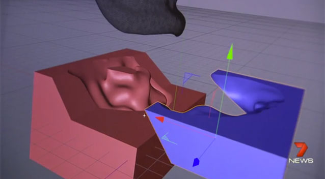 3d打印假耳 助力耳朵傷殘兒童恢復聽力
3D打印耳朵,3D打印假耳,上海3d打印店,上海3d打印公司,上海3d打印展覽會,上海3d打印展,上海3d打印園區,上海3d打印專用瞬間膠jls020,上海3d打印樓房,上海3d打印企業,上海3d打印展會,上海3d打印展覽,上海3D打印