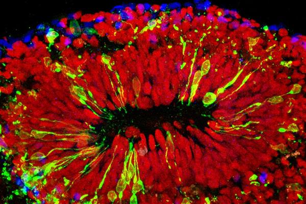 科學(xué)家攻克Zika病毒 高中生攜3D打印來幫忙
Zika病毒,3D打印醫(yī)療行業(yè),3D打印材料價格,3D打印技術(shù),3D打印材料,3D打印成本,3D打印價格