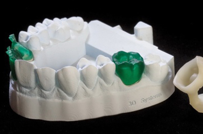 德國(guó)率先引入3D打印牙齒技術(shù) 全程體驗(yàn)“無(wú)痛”種牙-e鍵打印|3D打印服務(wù)
3d打印牙齒,3D打印種牙,無(wú)痛種牙,3D打印平臺(tái),3D打印服務(wù),南京哪里有3D打印,南京3D打印廠家,南京3D打印服務(wù)