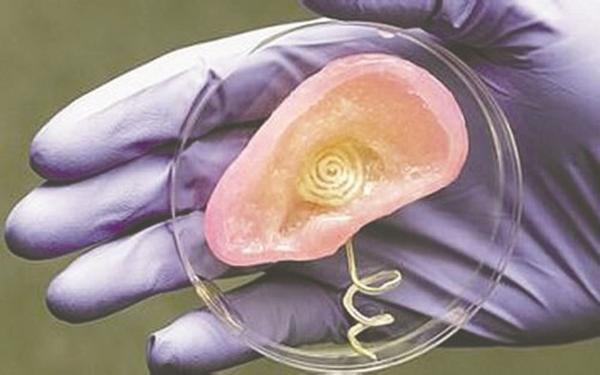 3d打印應(yīng)用案例:3D打印人體器官的那些事兒 3d打印應(yīng)用案例:3D打印人體器官的那些事兒