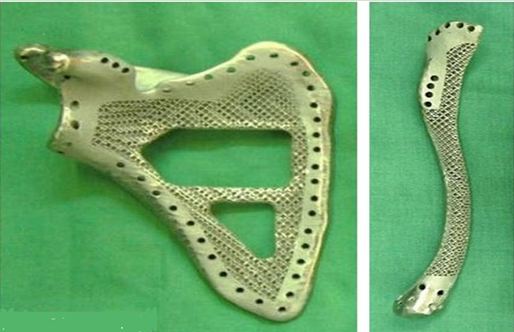 3d打印應用領域之醫療應用_e鍵打印服務公司 3d打印應用領域之醫療應用_e鍵打印服務公司