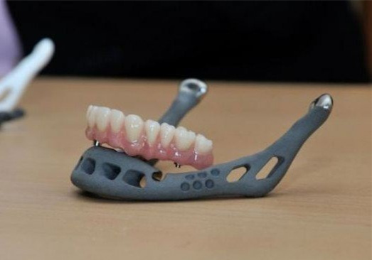 醫(yī)療3D打印的假牙 新手選擇3D打印手板模型加工打樣還是CNC加工?選擇當(dāng)?shù)剡€是全國3D打印公司? 醫(yī)療3D打印的假牙 新手選擇3D打印手板模型加工打樣還是CNC加工?選擇當(dāng)?shù)剡€是全國3D打印公司?