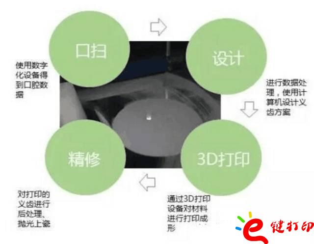 醫(yī)療輔助器械的變革之路 3d打印義齒(假牙)前景無(wú)限 勢(shì)在必行_醫(yī)療設(shè)備器械3d模型打印平臺(tái)