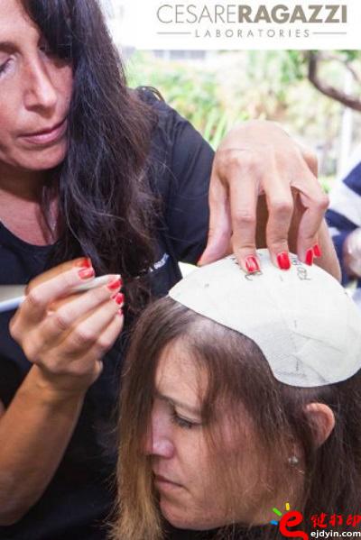 另類治療脫發(fā)的最好方法 用3D打印超逼真假發(fā)解決困擾 治療脫發(fā)不再煩,3d打印頭發(fā),假發(fā)3d模型,3d打印材料,3d打印服務(wù),3d打印廠家 另類治療脫發(fā)的最好方法 用3D打印超逼真假發(fā)解決困擾 治療脫發(fā)不再煩,3d打印頭發(fā),假發(fā)3d模型,3d打印材料,3d打印服務(wù),3d打印廠家