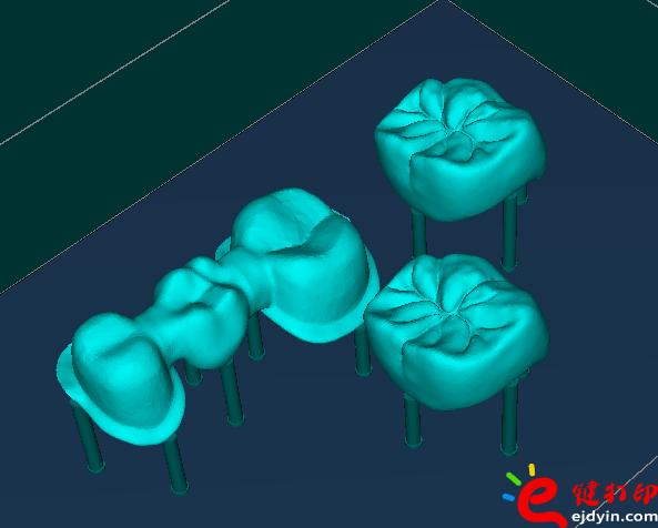 3d打印牙齒價格,3d打印牙齒模型,3d打印牙齒臨床了嗎,3d打印牙齒價格表,3d打印牙齒能用多久 3d打印牙齒價格,3d打印牙齒模型,3d打印牙齒臨床了嗎,3d打印牙齒價格表,3d打印牙齒能用多久