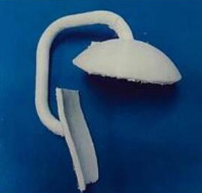 肩關節金屬植入物4